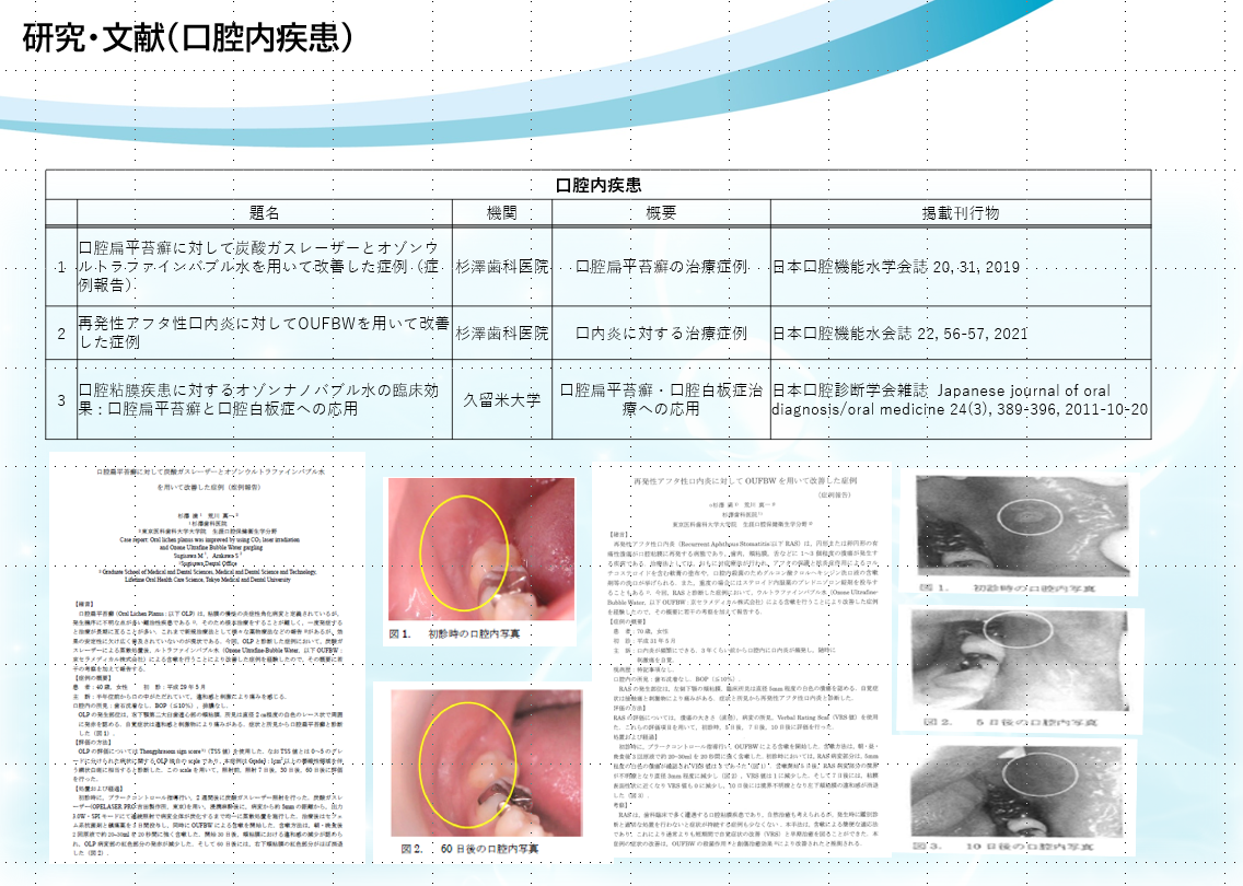 研究・文献（口腔内疾患）の写真